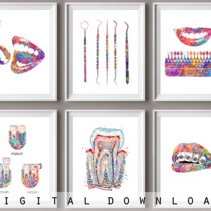 Cosmetic Dentistry Art Dental Set 6 Dental Clinic Decor Dentist Gift Dental Tools Veneers Braces Poster Medical Art Doctor Office Art