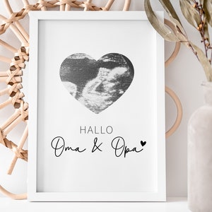 personalisiertes Ultraschallposter "Hallo Oma & Opa" | Schwangerschaftsverkündung | Personalisiertes Poster | Ohne Rahmen