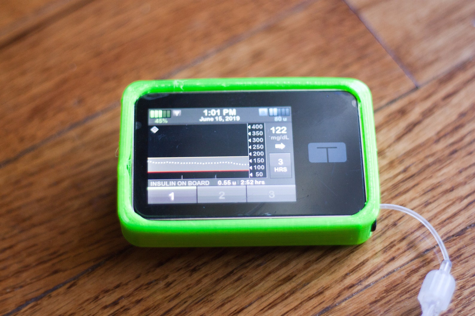 Custom Designed 3D Printed Tandem TSlim X2 Insulin Pump Case Etsy