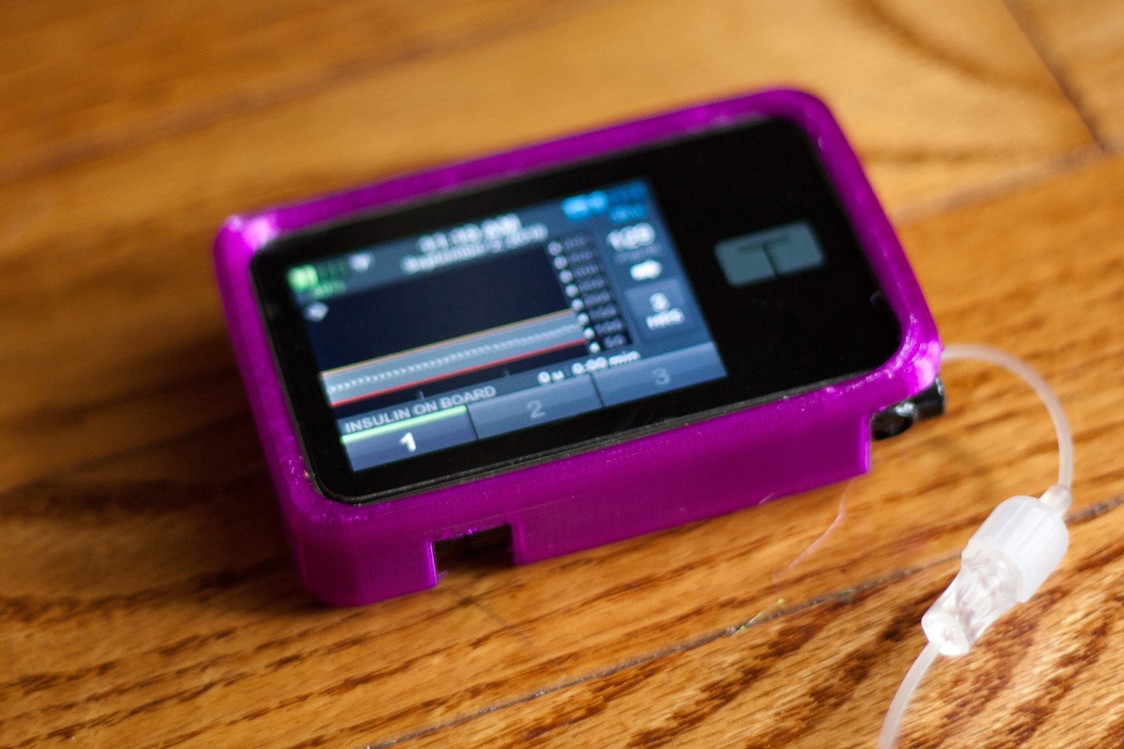 Custom Designed 3D Printed Tandem Tslim X2 Insulin Pump Case Etsy