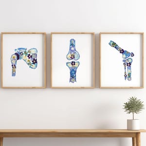 Orthopedic Anatomy Print Set Medical Wall Art for Traumatologist or Orthopedist Bone Structure Decor Set of 3