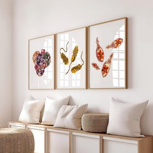 Digital Infectious Disease Prints – Set of 3 Microbiology Artwork, Bacteria Illustrations for Science