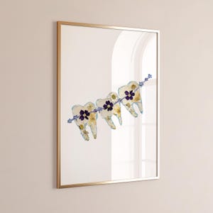Stampa artistica con fiori, apparecchio ortodontico floreale, illustrazione di fiori veri, decorazione da parete per dentisti, poster botanico per denti, stampa fisica