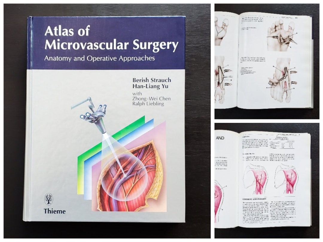 Atlas of Microvascular Surgery オンラインストア最安 | www