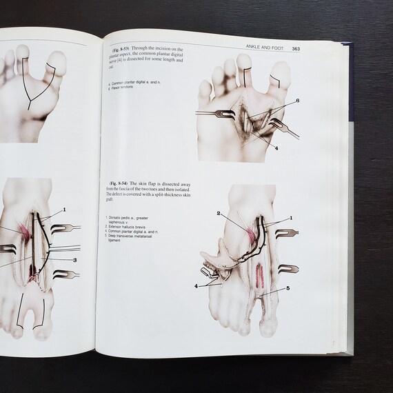 First Edition 1993 Atlas of Microvascular Surgery Anatomy