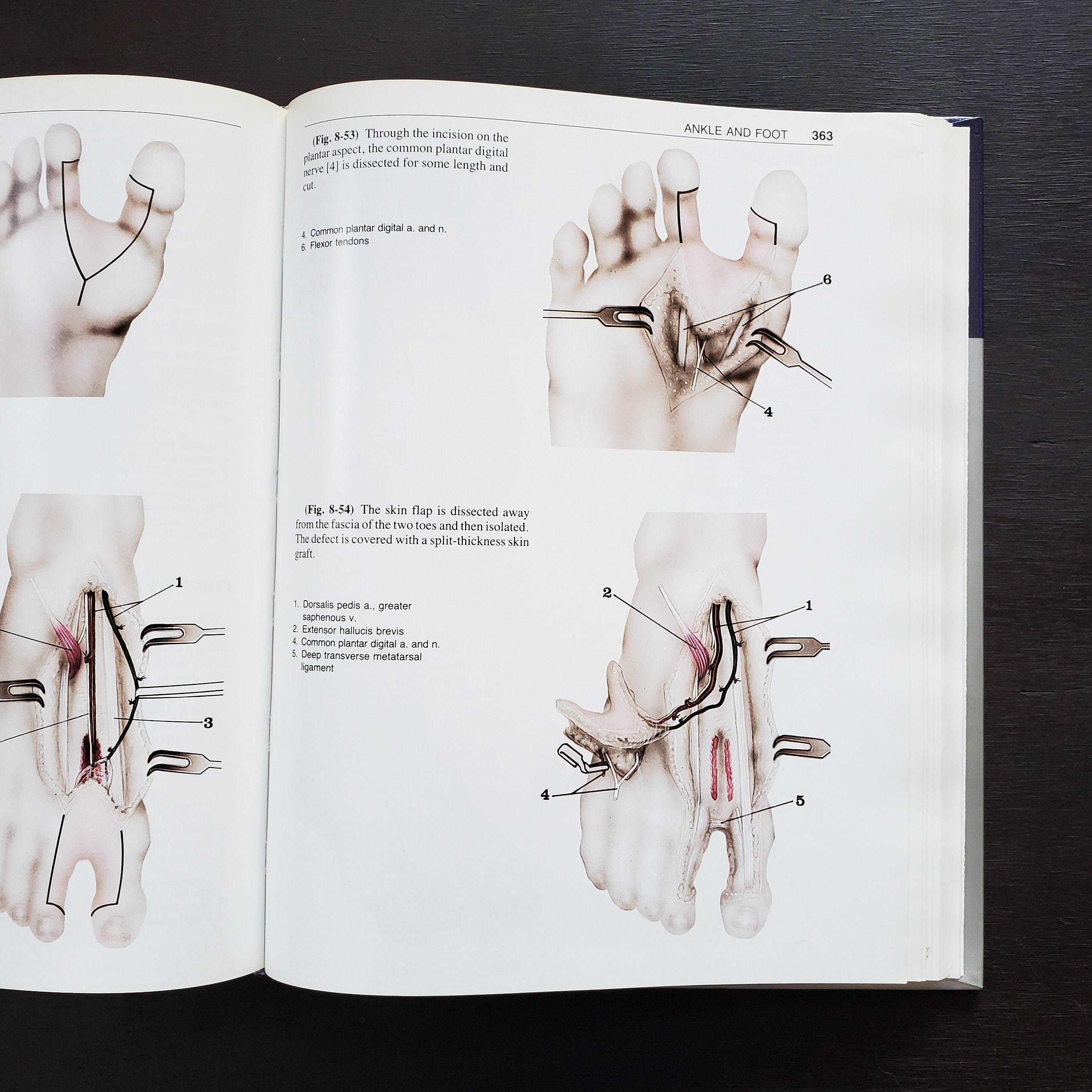 First Edition 1993 Atlas of Microvascular Surgery Anatomy and