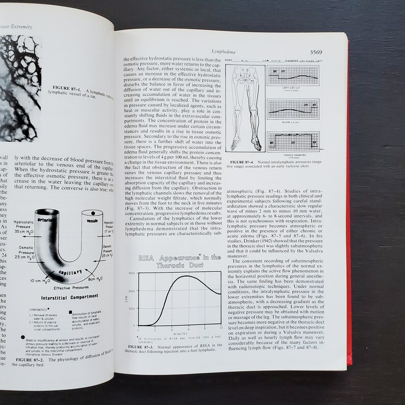 May include: A diagram illustrating the physiology of fluid diffusion in the capillary bed. The diagram shows a capillary with an arteriole and venule, and labels for hydrostatic pressure, osmotic pressure, and effective pressure. The diagram also includes a table with a list of factors that influence the movement of fluids in and out of the capillary.