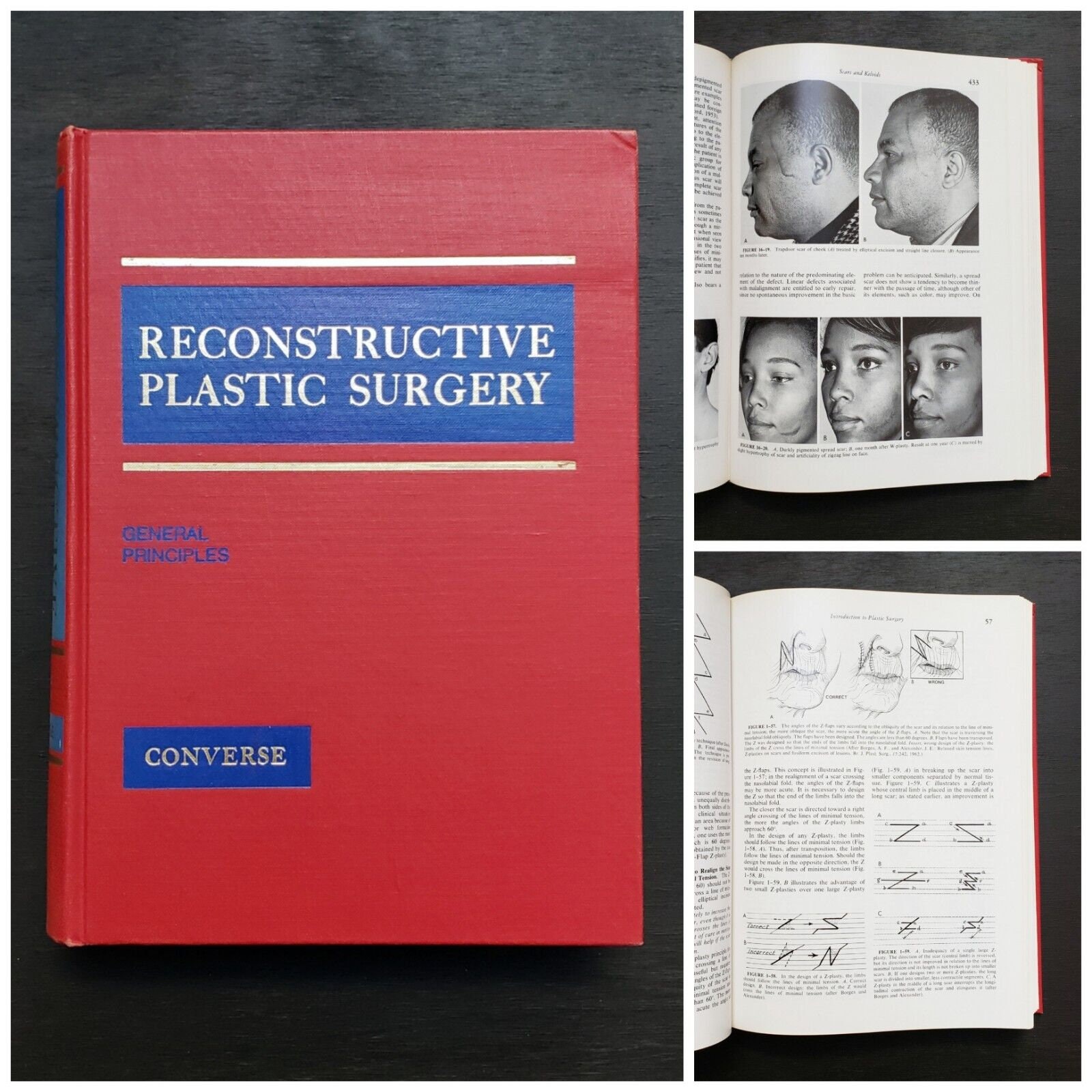 Vintage 1977 Second Edition Reconstructive Plastic Surgery Volume