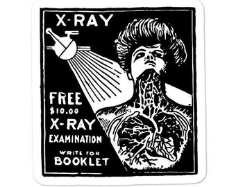 Vintage X-Ray Sticker | 1917 | Medical Sticker, Doctor Office, Doctor Gift, Vintage Medicine, Vintage Science, Science Sticker