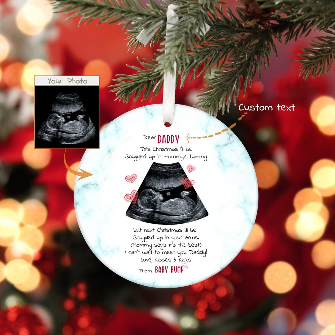Baby Ultrasound Ornaments 2023, Custom Ultrasound Gifts, Pregnancy