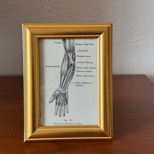 May include: A framed anatomical print of the human arm, featuring detailed illustrations of muscles with labels. The print is in a gold-colored frame. The text on the print includes muscle names such as "Triceps" and "Flexor carpi ulnaris".