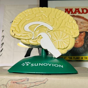 Vintage Anatomical Brain Model Advertising Display