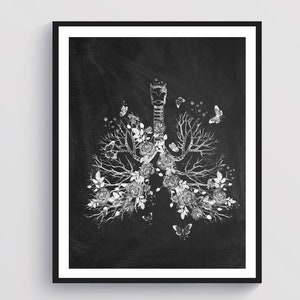 Bronchial Tree Art Lungs Anatomy Art Respiratory System Art Pulmonologist Office Gift Nurse Gift Chalkboard Art Medical Gift Clinic Decor