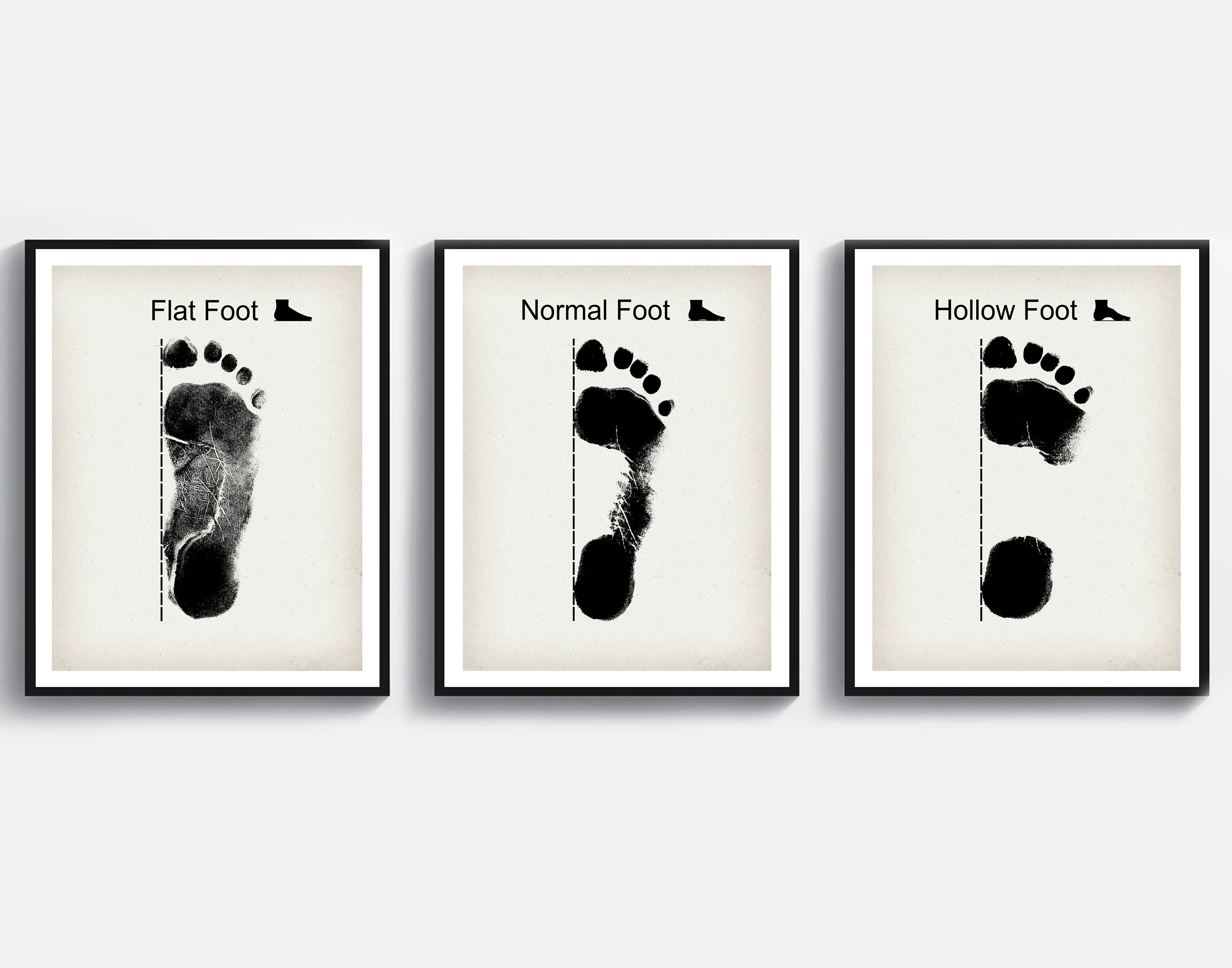 3 Footprint Art, Medical Art, Orthopedist Gift, Foot Pathology, Orthopedic Clinic Decor, Podologist Gift, Podiatrist Gift, Foot Care Art