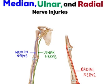 Nerve Injury/Dysfunction Chart (median, ulnar, & radial nerves)