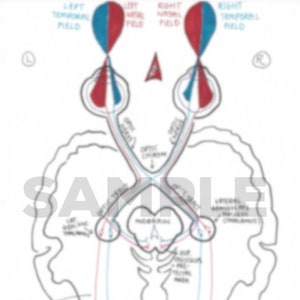 以下が含まれることがあります： 目は後頭葉に視覚経路を示す人間の脳の図。図は視神経、視交叉、視路を示しています。図はまた、意識的および無意識的な経路を示しています。図には、「LEFT TEMPORAL FIELD」、「LEFT NASAL FIELD」、「RIGHT NASAL FIELD」、「RIGHT TEMPORAL FIELD」、「OPTIC RADIATIONS」、「CONSCIOUS」、「UNCONSCIOUS」というテキストが含まれています。