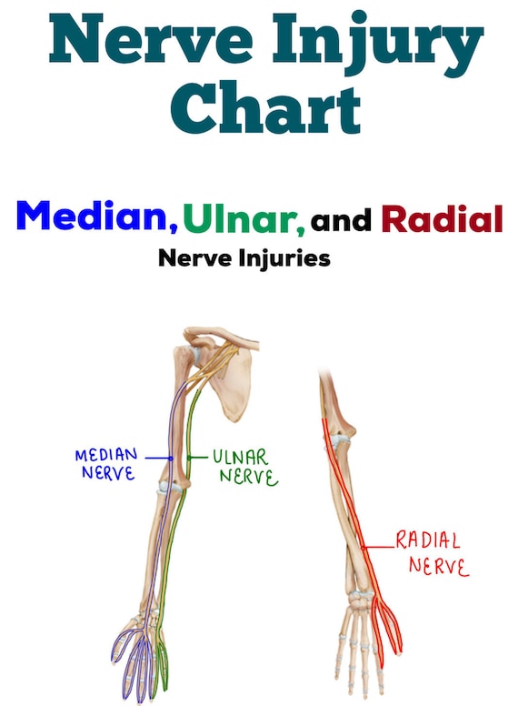 Nerve Injury/Dysfunction Chart median ulnar & radial | Etsy