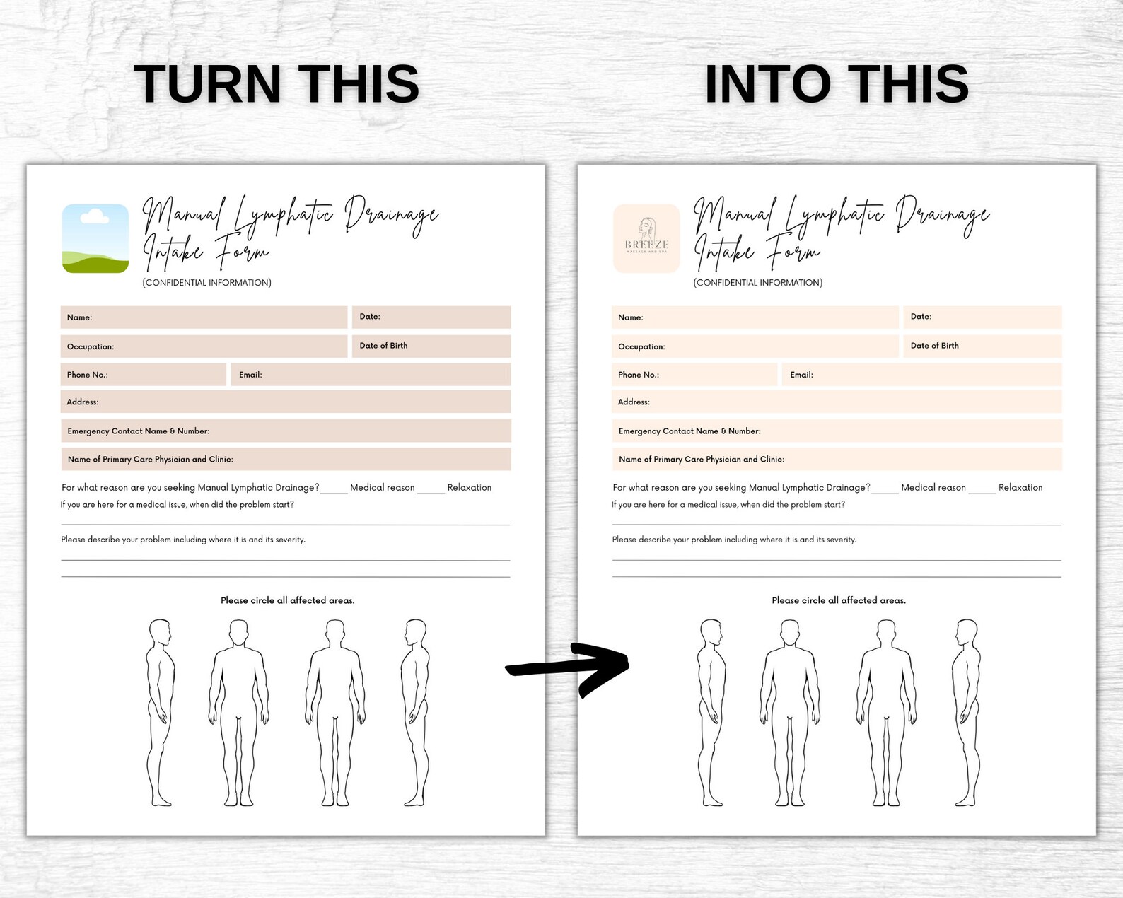 Editable MLD Manual Lymphatic Drainage Intake Form Informed Etsy