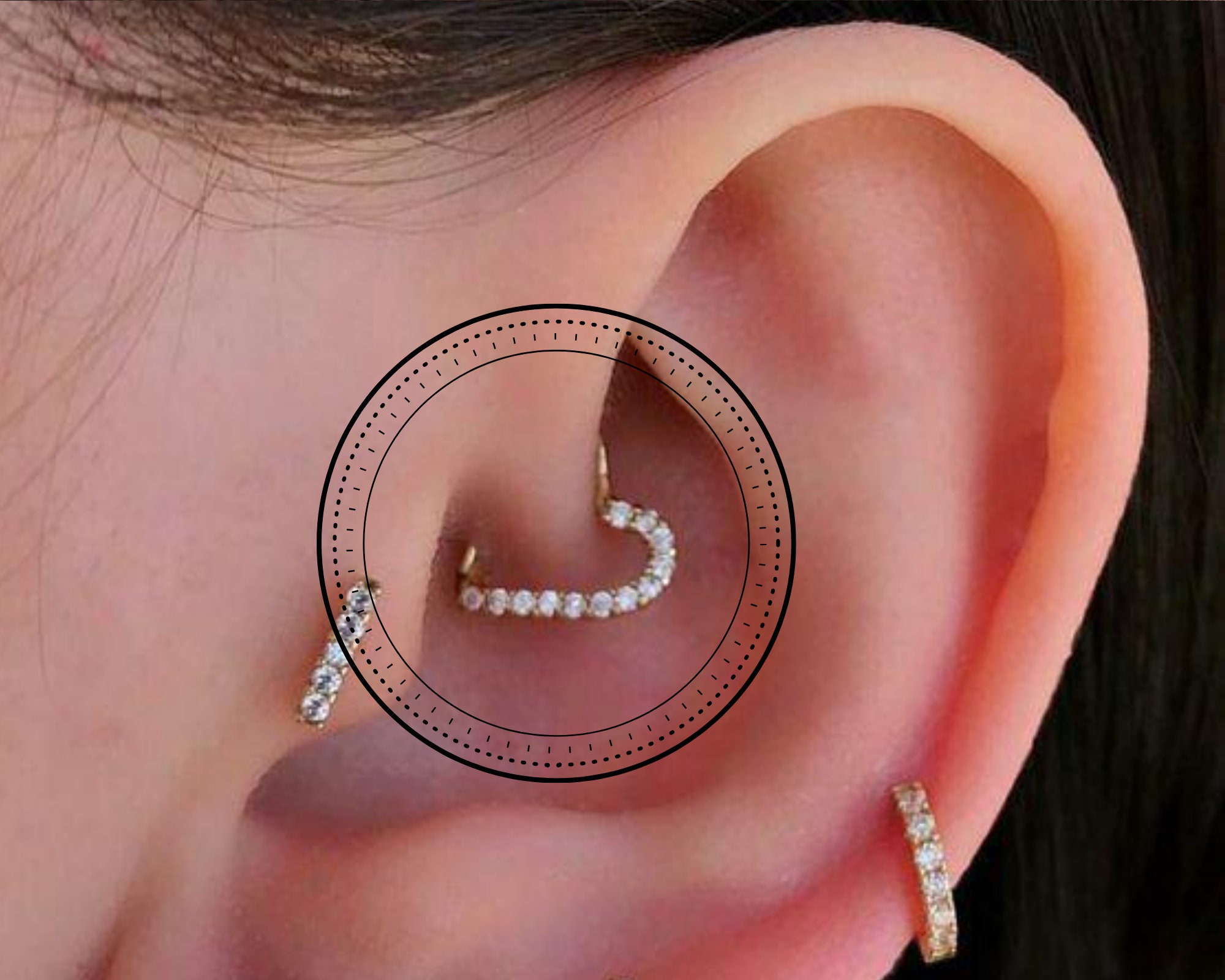 Piercing daith infectado