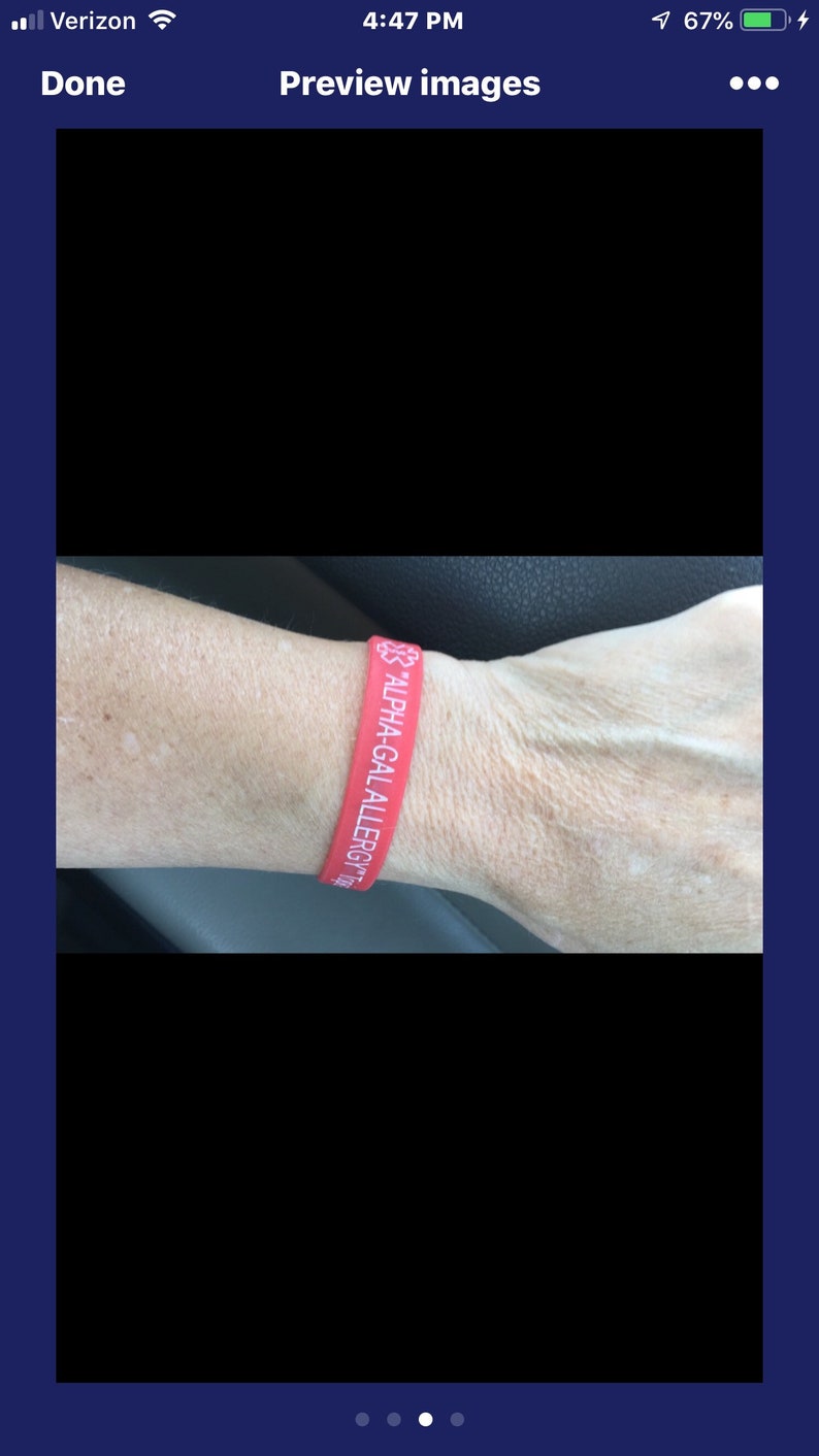 ALPHAGal Allergy Bracelet medical alert Etsy