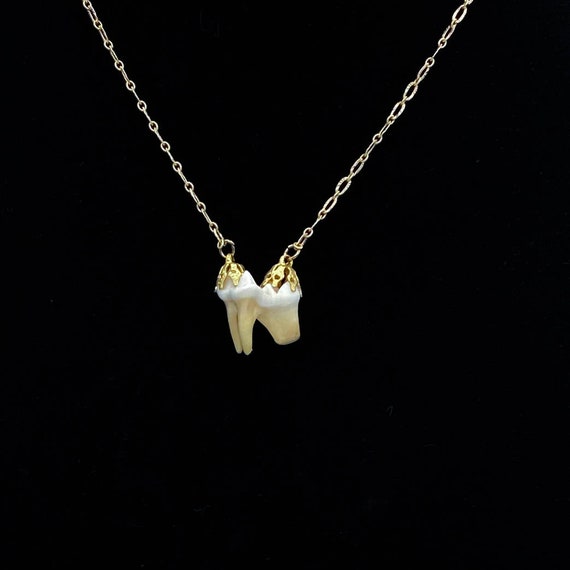 Necklace Tooth Animal | Pendants Tooth Animal | Necklace Wolf Tooth - Red  Necklace - Aliexpress