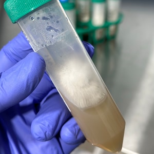 May include: A clear, conical tube with a green cap, containing a tan liquid and a white, fluffy substance. The tube is held by a gloved hand. Other tubes are visible in the background.