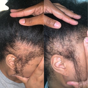 New & Improved!! Hair Growth oil