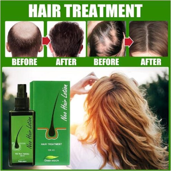 1X FAST USA NEO Hair Lotion Root Hair Treatment Nutrients - Etsy 1X FAST USA NEO Hair Lotion Root Hair Treatment Nutrients - Etsy