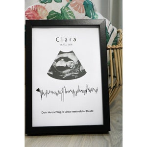 Geburtsposter mit original Herzschlag, Geschenk zur Geburt, Baby, Ultraschall, CTG