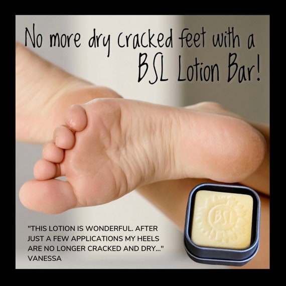 LOTION BAR / SOLID Lotion Bar / Fresh Beeswax Lotion Bar / Cocoa / Jojoba / Sunflower / Shea / Coconut / Quick Absorbing / Moisturizing