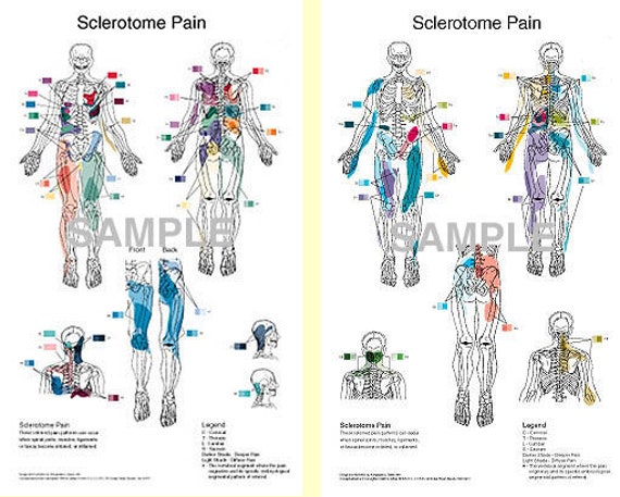 Sclerotome Poster Set  Etsy