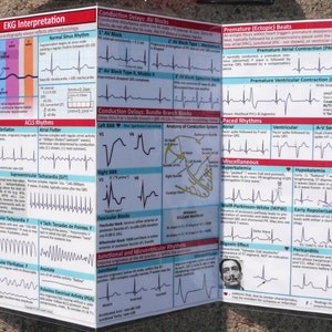Guia de bolso de ECG