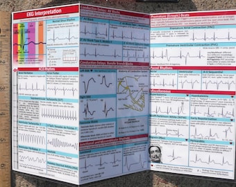 EKG Pocket Guide