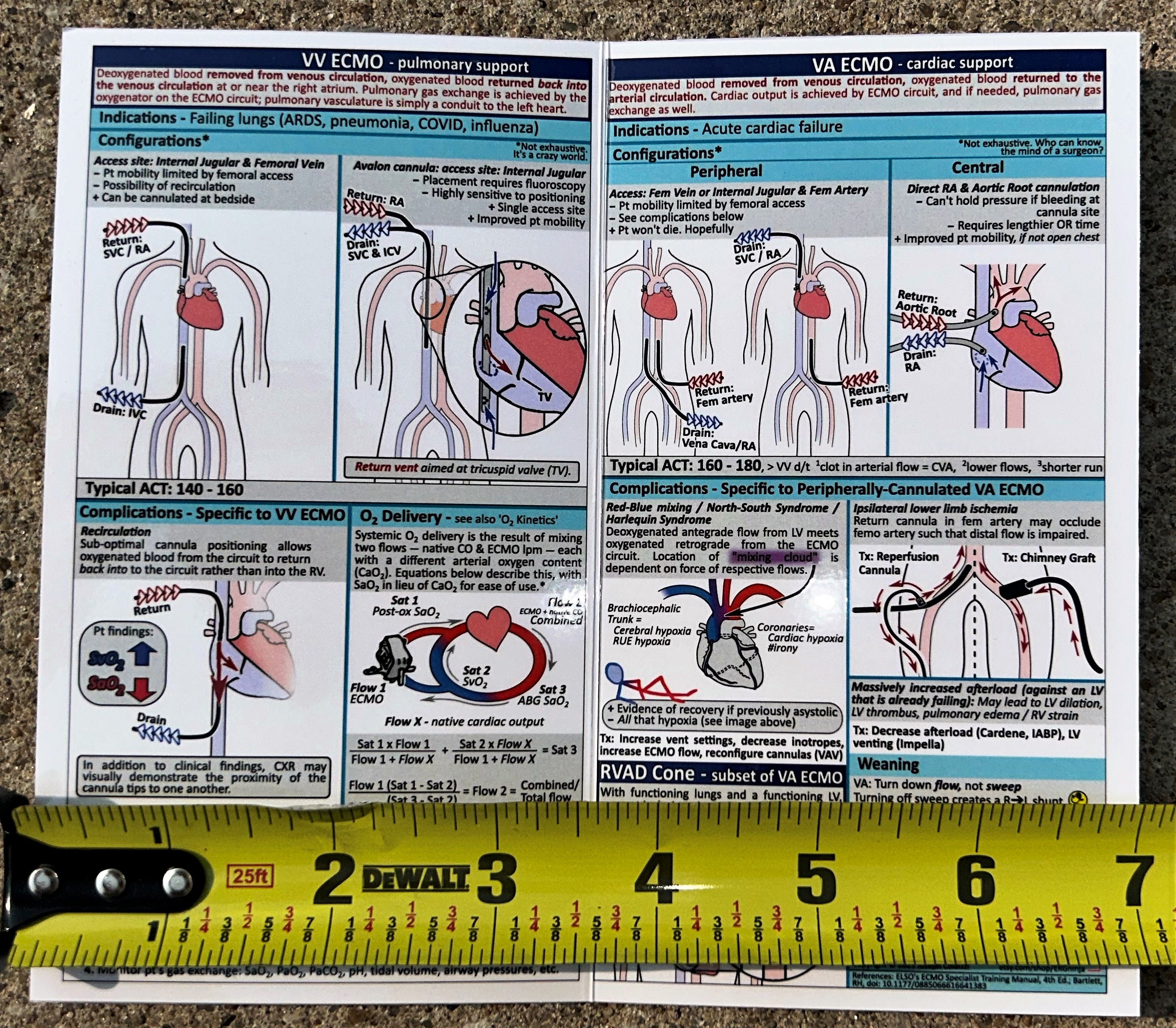 ECMO Pocket Guide - Etsy