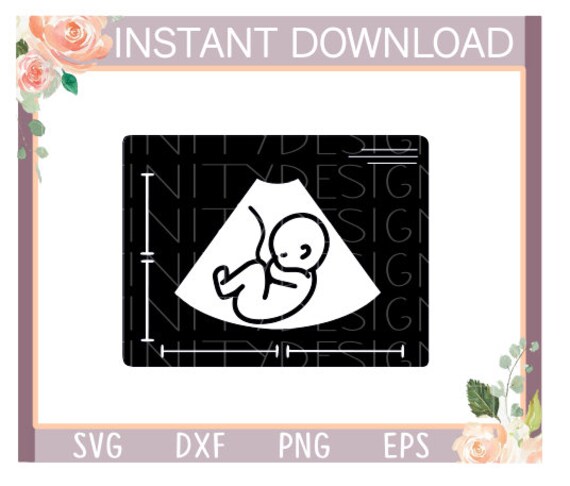 Download Ultrasound Svgpregnant Svgpregnancy Svgbaby Svgpregnancy Etsy