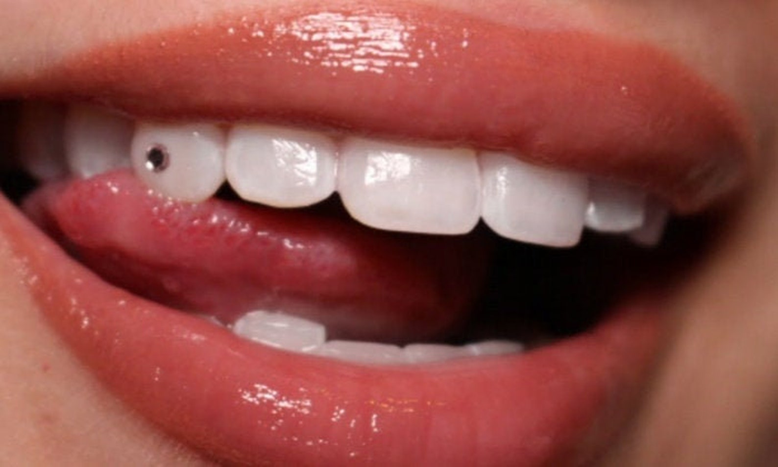 10 Teeth / tooth gems dental diamonds gemstones Etsy