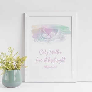 Watercolour Baby Scan Print, Ultrasound Art, Sonogram, Pregnancy announcement, Baby Print, Pregnancy Print, Scan Print, Pregnancy Keepsake