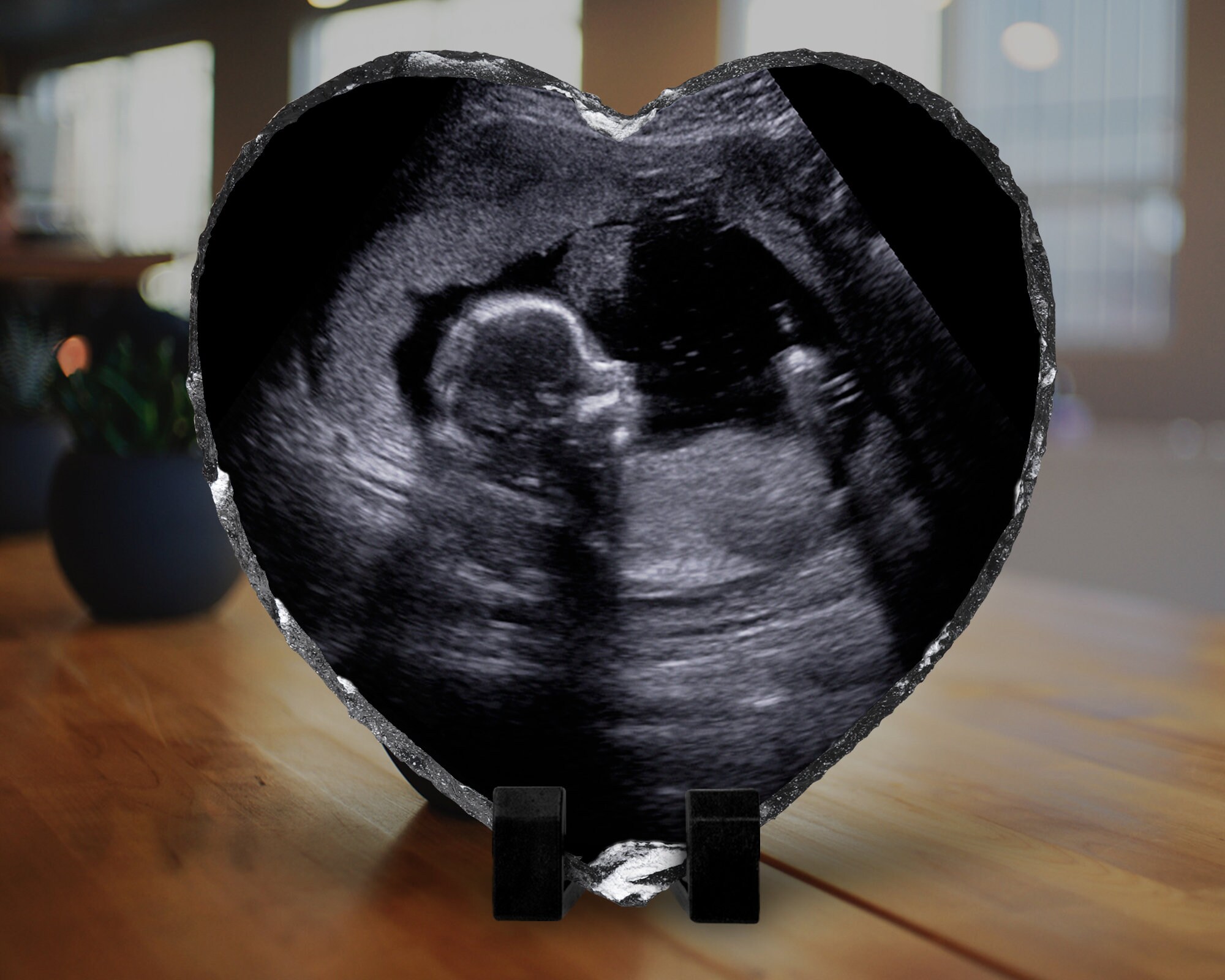 Personalised Scan Photo Plaque Ultrasound Keepsake Slate Etsy