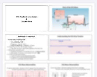 ECG-ritmekaarten (DIGITAAL)