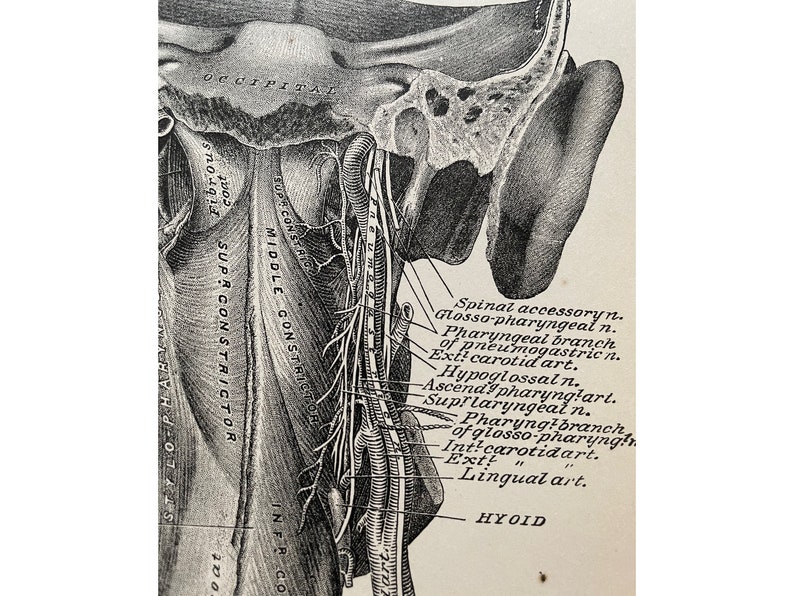 Anatomy Print, 1888 NYC, Autopsy Print, Antique Print, Dissection Print ...