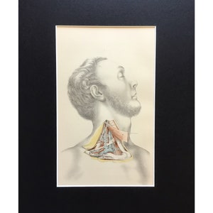 Antique Anatomy Print, Subclavian Vessels, Printed In 1882 , NYC , Dissection, Mounted Print Ready To Frame, Human Biology