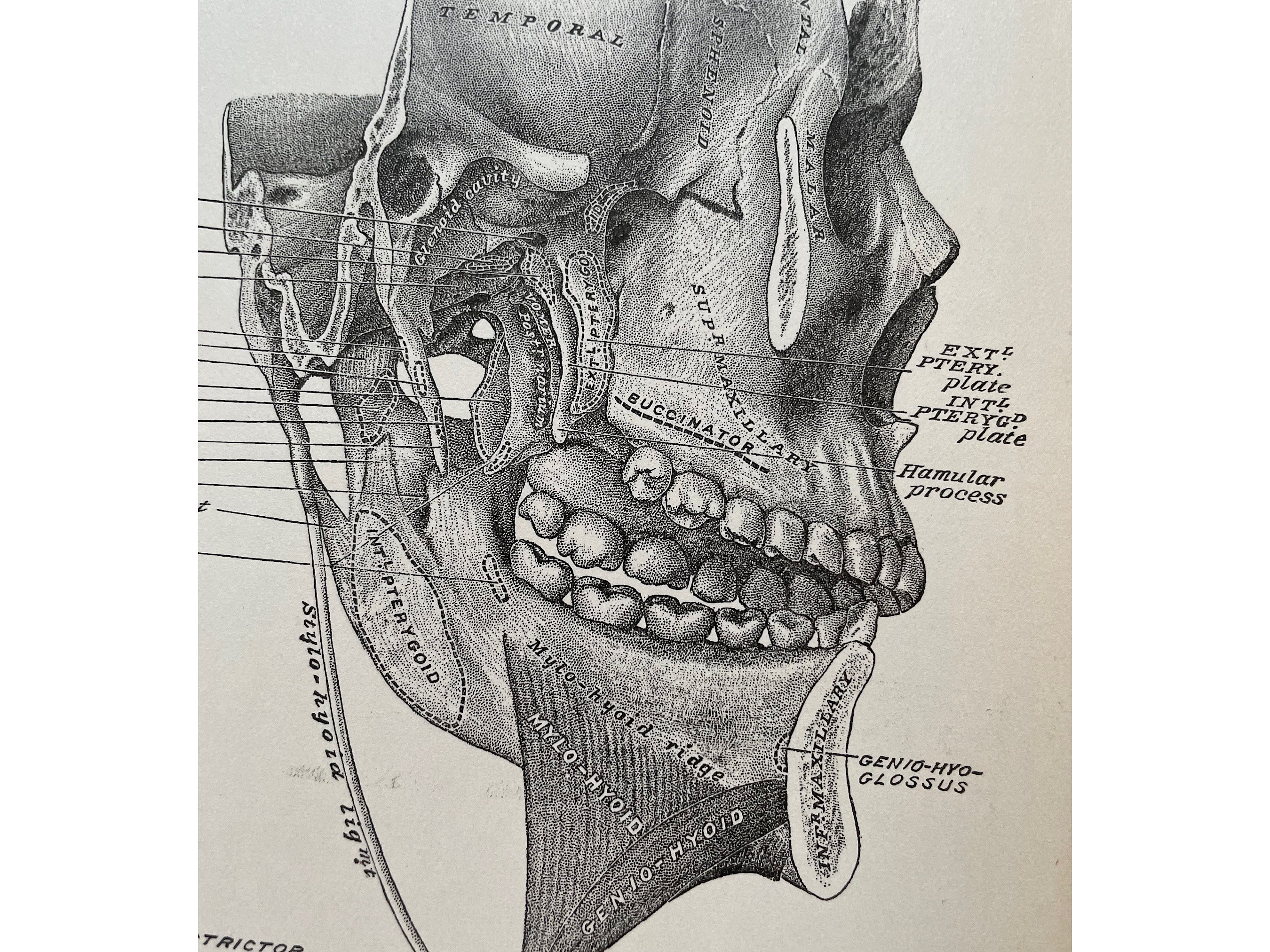 Anatomy Print, 1888 NYC, Autopsy Print, Antique Print, Dissection Print ...
