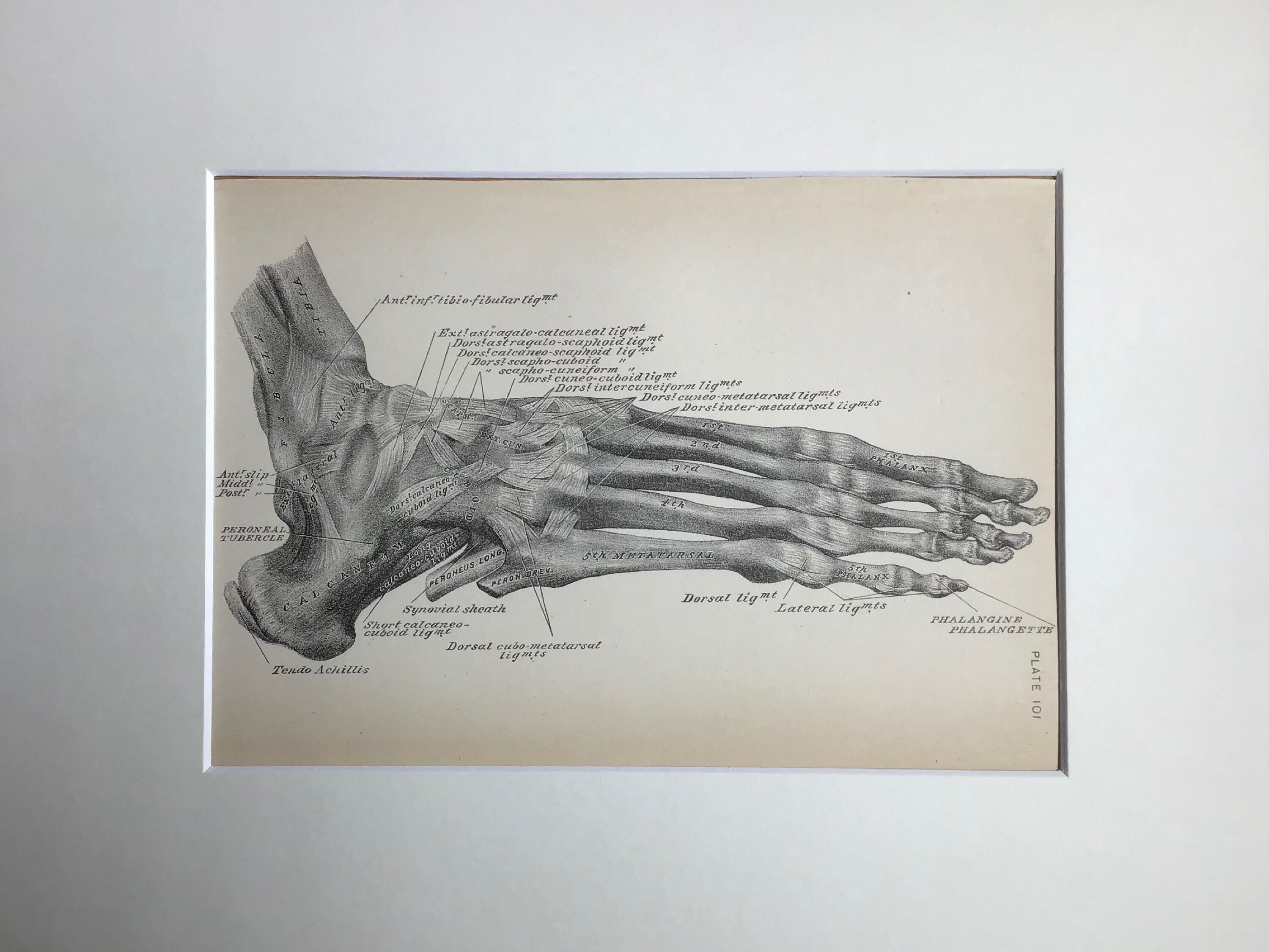 1850 Anatomy of Human Skeleton, Anatomical Drawing, NEW Fine Art