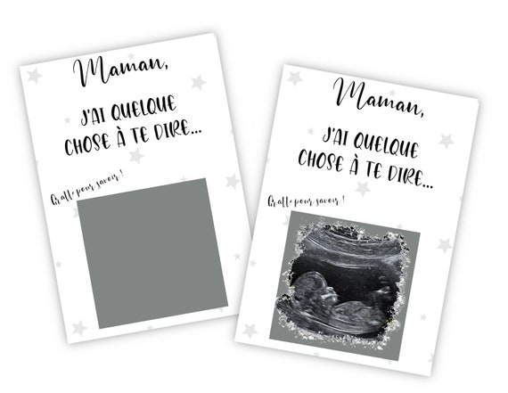 Carte à gratter personnalisable avec votre échographie pour annoncer votre  grossesse