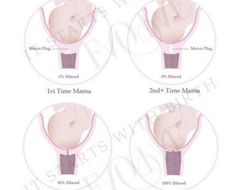 Labour and Birth - Cervical Effacement: Designed for birth class, midwives, doctors, doulas, birth-workers
