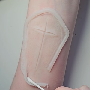 Puede incluir: Un molde de silicona blanco en forma de cruz en el brazo de una persona. El molde se está despegando con un hisopo de algodón.