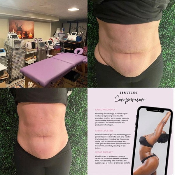 Body Contouring in-person treatments- Melt fat away for the summer/Must Contact 1st w/free Consultation prior to purchase.