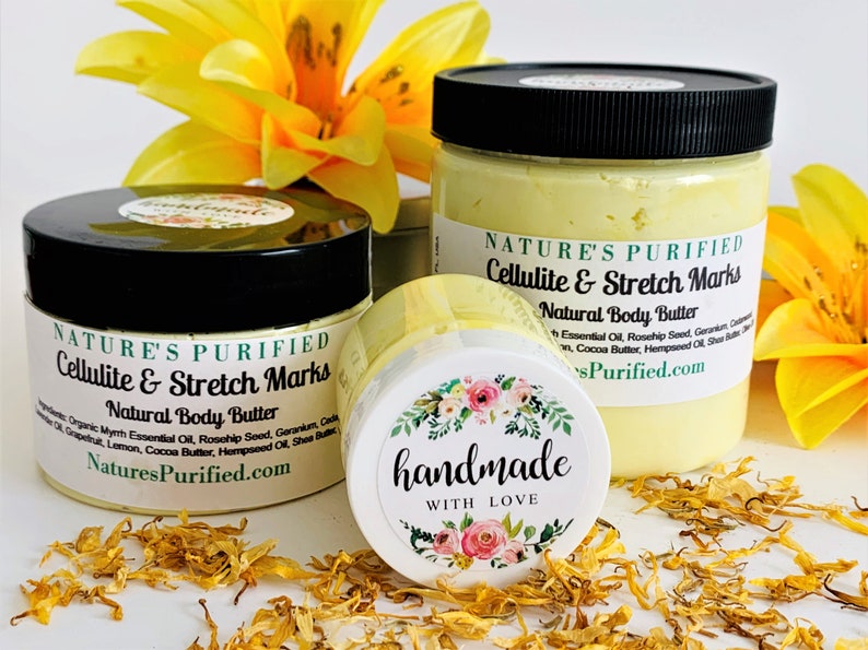 Cellulite Stretch Marks Body Butter Body Whipped Cream Skin Etsy