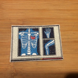 Peut inclure: Écusson brodé représentant un dessin de radiographie en bleu et blanc. Le motif comprend une poitrine, une main et un genou, avec un détail de cœur rouge. L'écusson a une bordure blanche et est posé sur un fond en bois.
