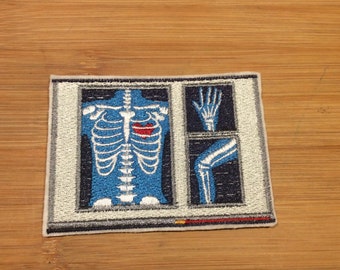 Embroidered X-Ray Image Patch by Twistedstitcher 2018 Located in Abbotsford BC Canada